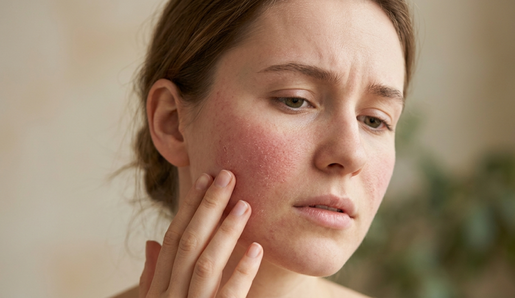 damaged skin barrier showing redness dryness and uneven texture
